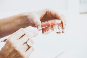 implantes-dentales-de-carga-inmediata
