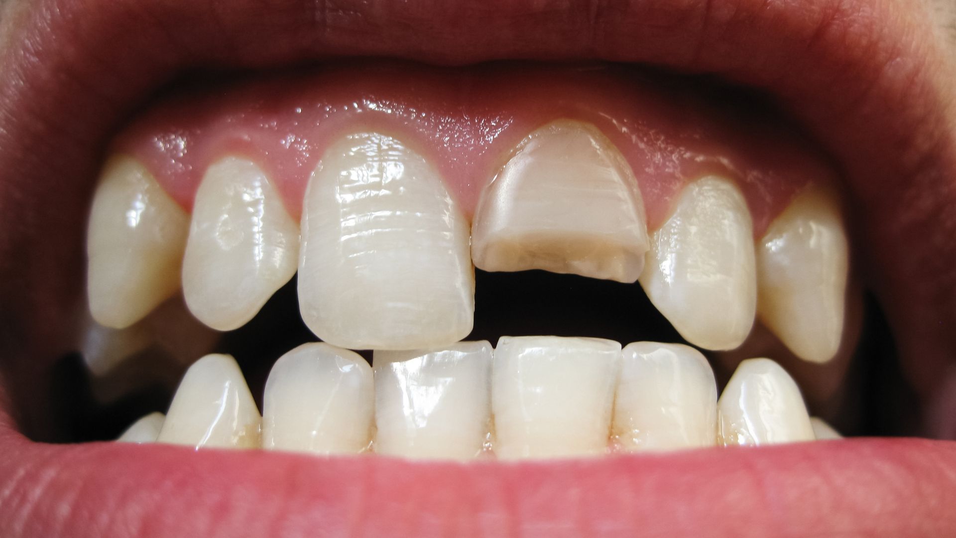 URGENCIAS DENTALES