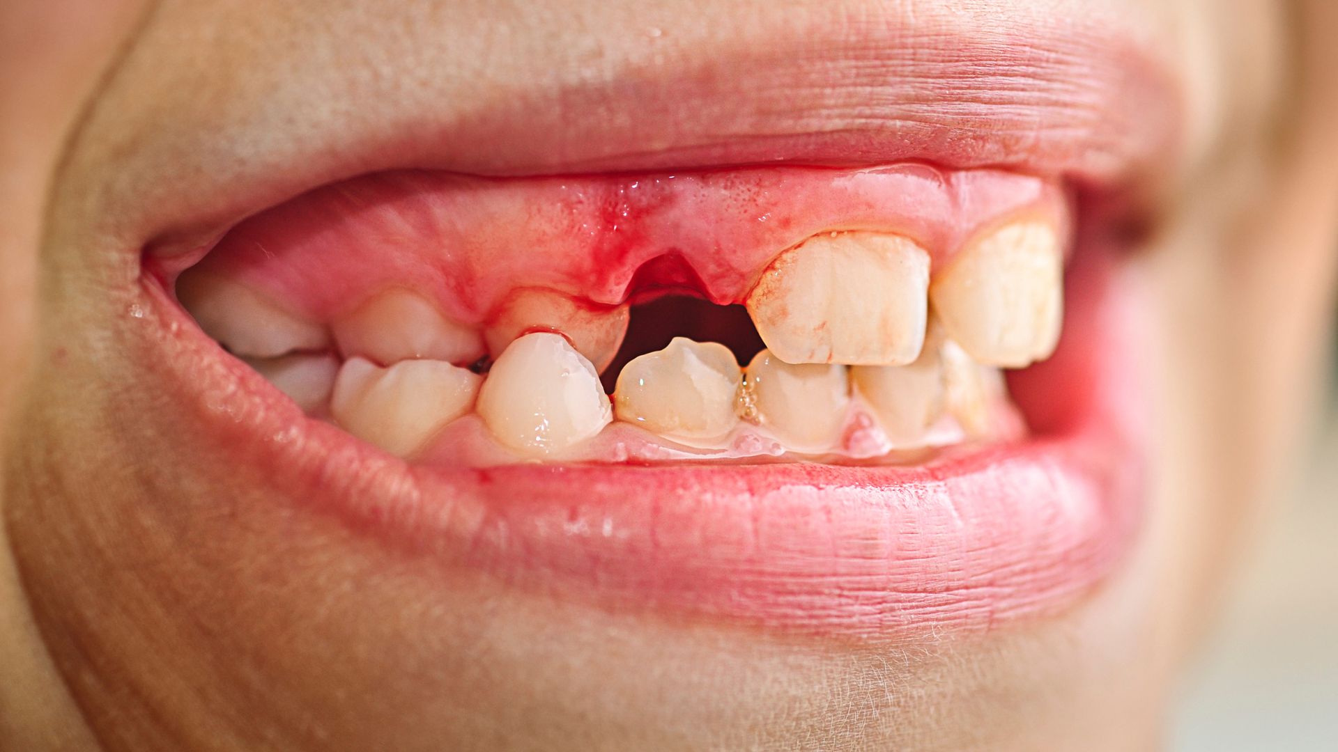 URGENCIAS DENTALES