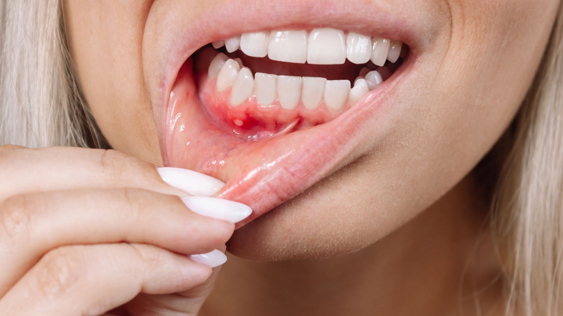 URGENCIAS DENTALES